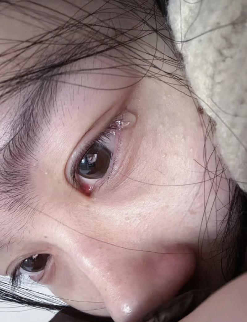 sad crying eyes dp for whatsapp