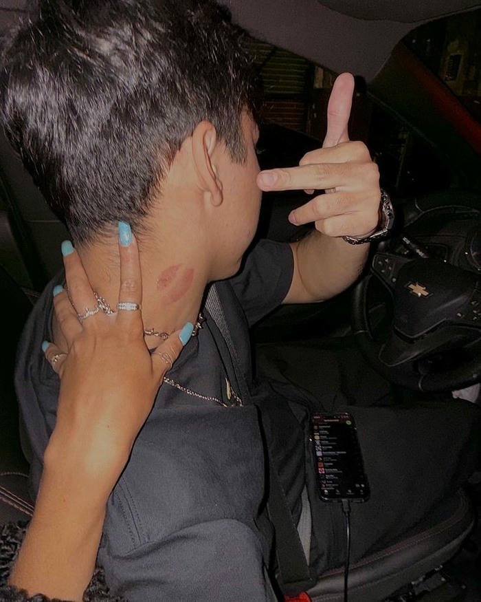 Love bites images boy rude gesture neck hickey view