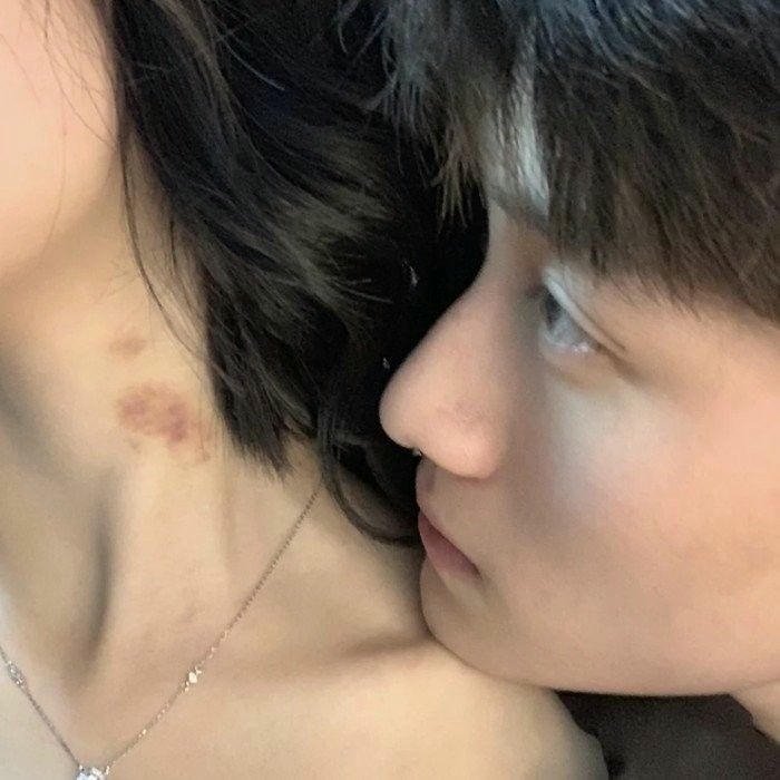 Love bites images couple kissing neck red mark close