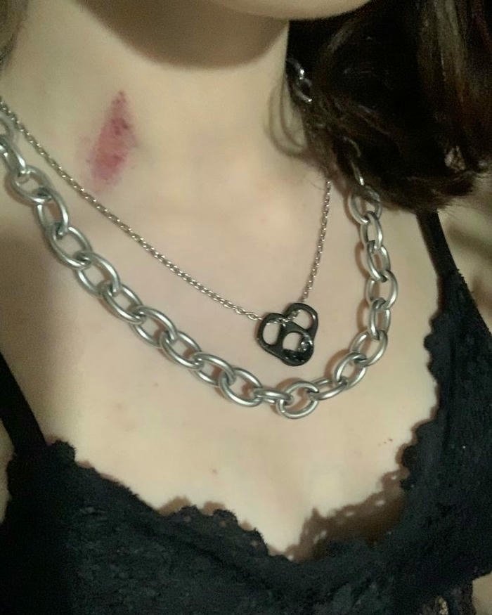 Love bites images woman black lace necklace bite mark