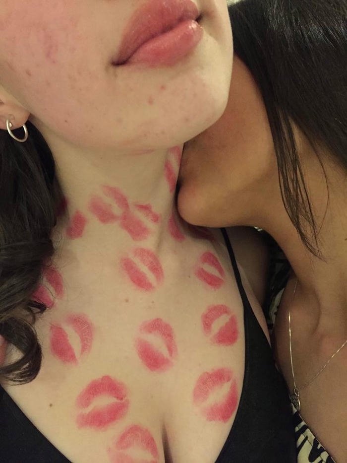 Love bites images woman chest covered red kiss marks