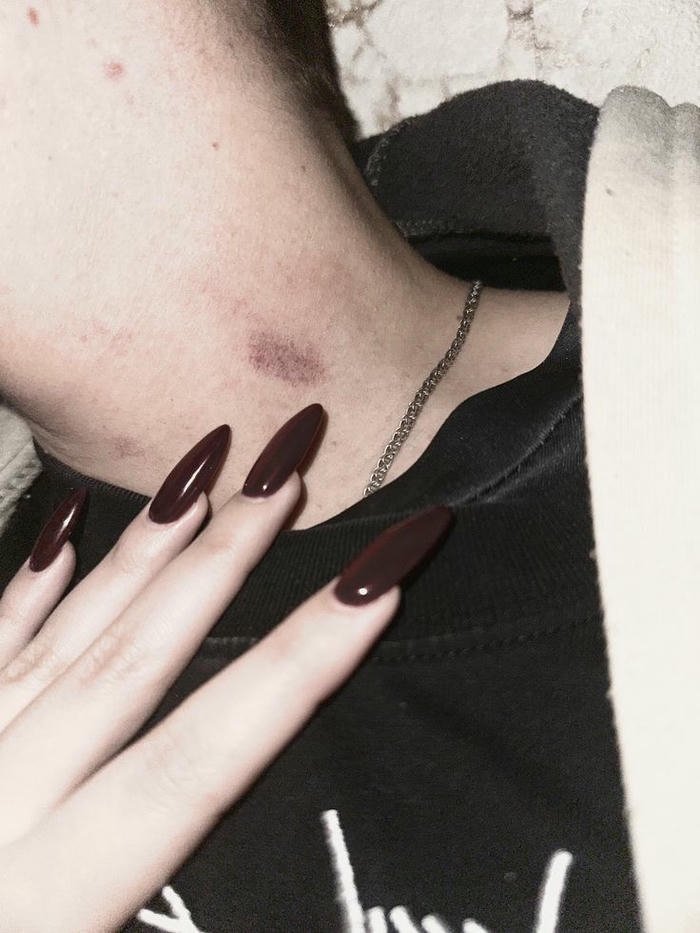 Woman black top neck dark red hickey view