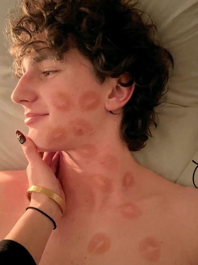 203+ Cute Love Bites Images Showing Passionate Moments